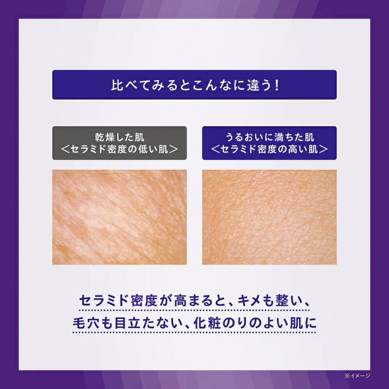 ネコポス速達!コーセー セラムヴェール ディープリペア 9ml ミニサイズ 特製サイズ サンプル 薬用導入美容液 医薬部外品 乳酸菌配合 うるおい改善 もっちり潤密肌へ 奥深く浸透 素肌力向上 乾燥悩みを解決 KOSE kose - 画像 (5)